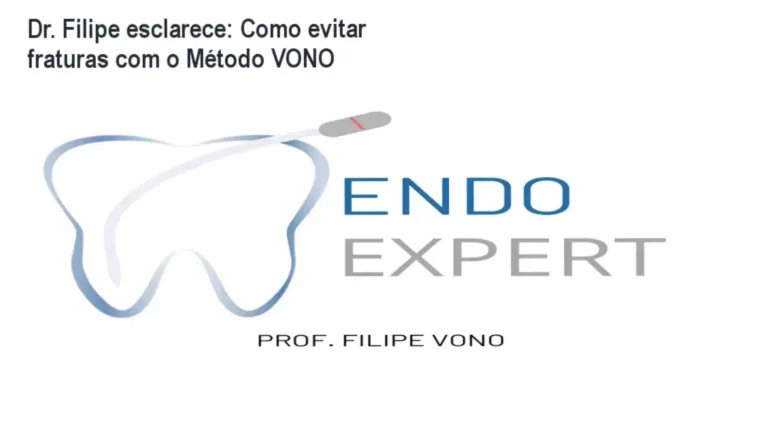 Dr. Filipe apresentando o kit de limas do Método VONO para endodontia complexa