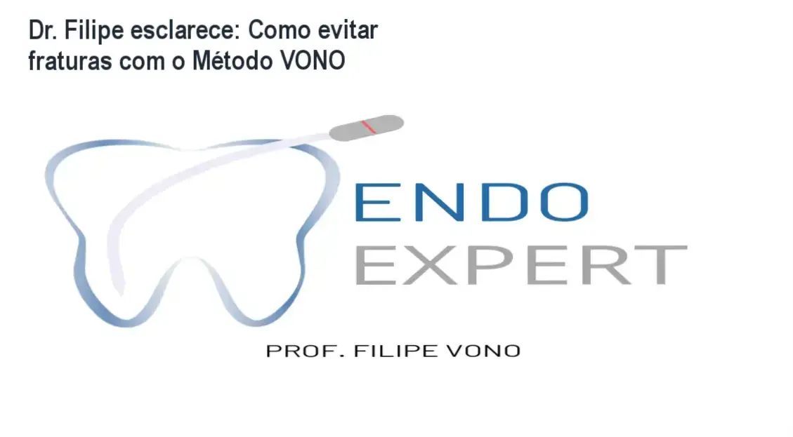 Dr. Filipe apresentando o kit de limas do Método VONO para endodontia complexa