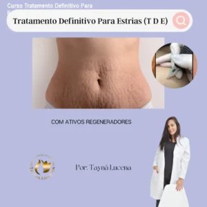 Curso Tratamento Definitivo Para Estrias: Como Comprar Original