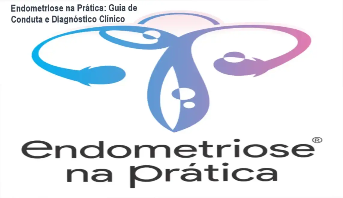 Interface de aulas do curso Endometriose na Prática do Dr. Vinícius Araújo mostrando módulos de conduta clínica