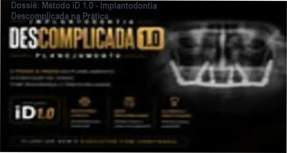 Dr. Leonardo Lafuente demonstrando planejamento tomográfico para ancoragem avançada em maxila atrófica no Método iD 1.0