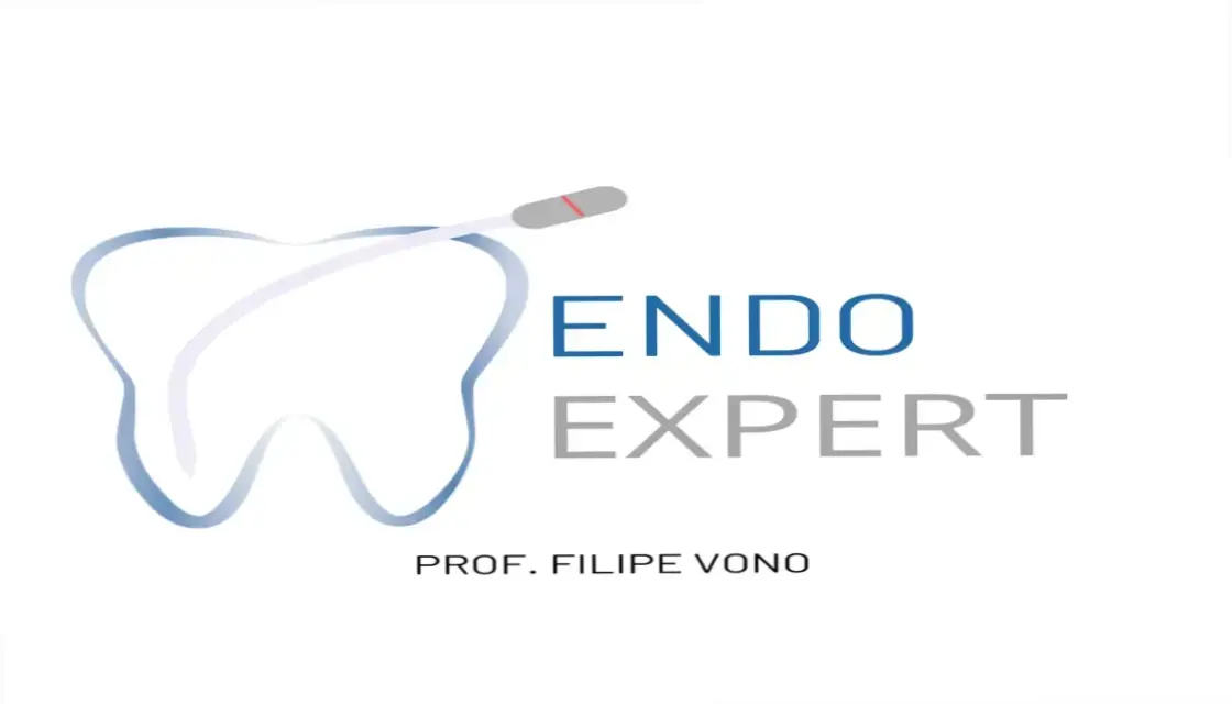 Método VONO Dr. Filipe: Avaliação Técnica e Veredito Final 2 https://cursoss.com.br/ola-produtividade-saudavel-analise-tecnica/ Kit de Limas Vono e materiais didáticos do Método VONO do Dr. Filipe para Endodontia